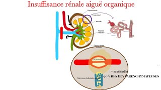 Physiopathologie de lIRA ogranique [upl. by Sonia322]