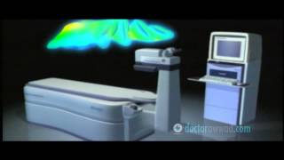 Customized wavefrontguided Treatments LASIK amp PRK English [upl. by Primrose]