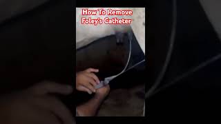 How To Remove Foleys Catheter Dr Hafiz Nadeem Ur Rehman vet viral shortsfeed [upl. by Atinit]