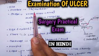 Examination Of Ulcer In Surgery  Ulcer Examination  Surgery Practical Exam [upl. by Elleret]