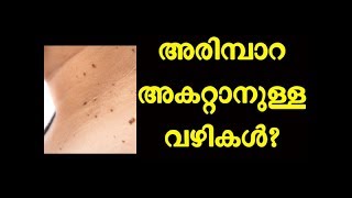 അരിമ്പാറപാലുണ്ണി എന്നിവ അകറ്റാനുള്ള സിമ്പിൾ വഴികൾ How To Get Rid Of Warts [upl. by Ecinaej]