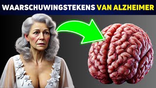 SCHOKKEND Deze 5 Gewoonten Zijn Verbonden met Alzheimer [upl. by Cynthla903]