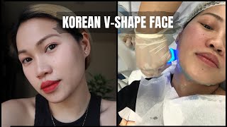 HOW TO ACHIEVE KOREAN VSHAPE FACE  EXILIS REVIEW [upl. by Akilak201]