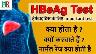 hepatitis B e Antigen  HBeAg test in hindi  hbeag negative means  hbeag positive means [upl. by Clabo127]