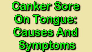 Canker Sore On Tongue Causes And Symptoms [upl. by Lorou]