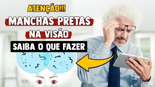 Você enxerga SUJEIRINHAS flutuando nos olhos O que são Tem como tratar São perigosas [upl. by Cotsen335]