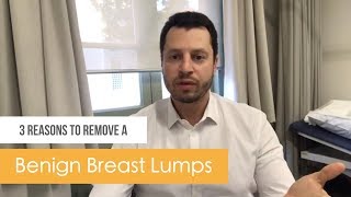 3 Reasons to remove a benign breast lumps [upl. by Drice]