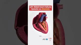 Systolic vs Diastolic Heart Failure 🫀 [upl. by Newel]