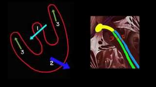 CURSO DE ELECTROCARDIOGRAFIA 43  BLOQUEO DE RAMA DERECHA [upl. by Anaes]