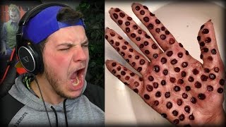 ULTIMATE TRYPOPHOBIA TEST WARNING GROSS [upl. by Eanerb]