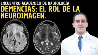 V Encuentro Académico de Radiología Demencias  El rol de la neuroimagen [upl. by Meeka]