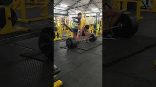 Dislocation During 190kg Dead Lift shortvideo youtubeshorts deadlift 190 injury [upl. by Wrand]