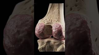 Osteoarthritis of knee shortsknee jointligamentmeniscusdoctorvlogger [upl. by Alwin]