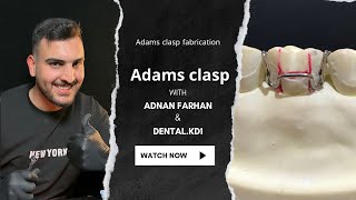 اسهل طريقة لتصميم ادم كلاسب  Adams clasp Adams clasp fabrication [upl. by Avivah]