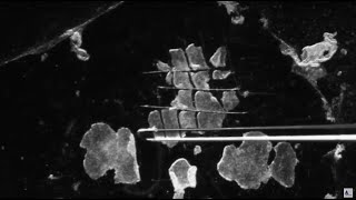 3 Methods for Passaging of Pluripotent Stem Cells [upl. by Adnirual]