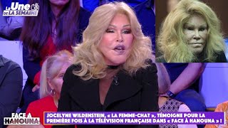 Jocelyne Wildenstein  à 84 ans la femme chat subjugue Cyril Hanouna [upl. by Ayatahs174]