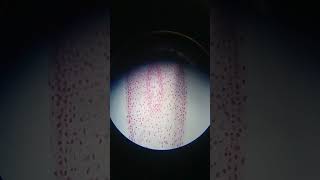 Microscopic practical of Mitosis ProphaseMetaphaseAnaphaseTelophase [upl. by Cianca101]