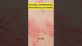 Solución sulfato de zinc para herpessulfatodezinc herpes [upl. by Siram688]