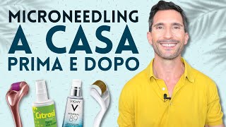 MICRONEEDLING A CASA PRIMA E DOPO [upl. by Buddy]