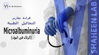 كيفية قراءة تحليل microalbuminuria [upl. by Nnylsoj]