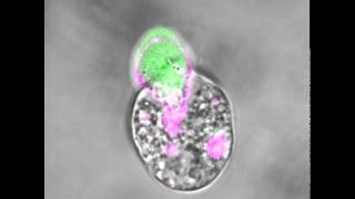 An amoeba eating a human cell [upl. by Nodnahs641]