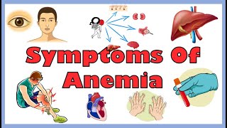 Common Signs amp Symptoms Of Anemia Iron Deficiency Hemolytic amp Other Anemias  Anemia Symptoms [upl. by Rica]