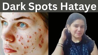 Dark Spots Remover Karne Ka Simple Tarika beautyblogdeepti [upl. by Eikcin]