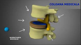 DECOMPRESIA VERTEBRALA TRIDIMENSIONALA PENTRU HERNIA DE DISC [upl. by Violetta]