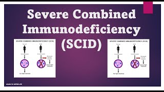 Severe Combined Immunodeficiency SCID  Immunology USMLE Step 1 [upl. by Ynavoeg]