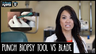 Removing Cysts Choosing between Punch Tool and Surgical Blade [upl. by Gardner9]