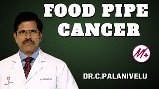 Adenocarcinoma  Food Pipe Cancer  Esophageal Cancer   DrCPalanivelu [upl. by Zetra]