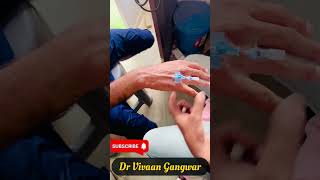 How to Insert Cannula  Cannula Insertion  IV Cannula  IV CATH  कैनुला लगाने का तरीका shorts [upl. by Akihsal614]