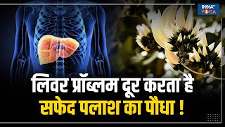 White Palash Plant लिवर की गंभीर बीमारी का रामबाण इलाज है सफेद पलाश का पौधा  Liver Disease [upl. by Maude]