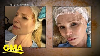 Christie Brinkley reveals skin cancer diagnosis [upl. by Rudolf806]