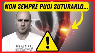 Lesione del MENISCO 🔴 Non tutte le ciabelle vengono col buco [upl. by Euqinom255]