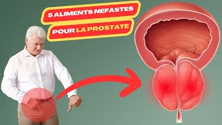 5 aliments néfastes pour la prostate  cancer de la prostate  prostate test  prostatique [upl. by Nodal222]