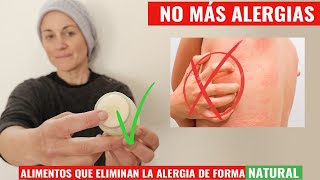 Como Eliminar Tu Alergia  Crema Natural para aliviar la picazón fácil y econóimica [upl. by Goldsworthy196]