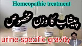 urine specific gravity \ Clear urine frequent urination nausea \ specific gravity normal [upl. by Vincenta]