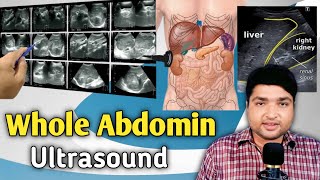 Whole Abdominal Ultrasound Procedure by Dr Ali Waqar [upl. by Asik966]