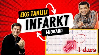 MIOKARD INFARKTI EKG TAHLILI [upl. by Arica]