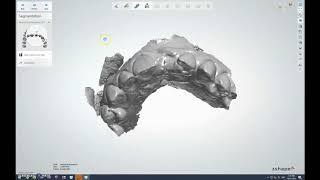 Modify implant abutment typestibases in 3shape [upl. by Gunas638]