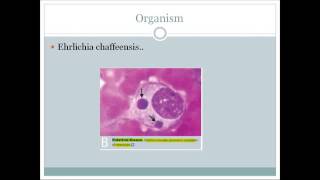 Ehrlichiosis An integrated discussion for USMLE step 1 [upl. by Haem]