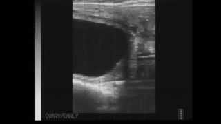 Ultrasound Quiz  Pregnant or Open questions [upl. by Hinman478]