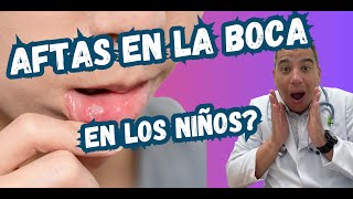 Gingivoestomatitis en niños Todo lo que necesitas saber sobre ampollas bucales [upl. by Rolyab830]