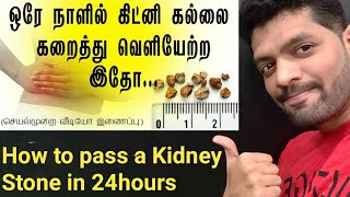 சிறுநீரக கல் சுலபமாக கரைய எளிய வழிHome Remedy to cure Kidney Stone in TamilKidney stone treatment [upl. by Woody]