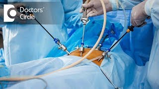 5 benefits of Gynaec Laparoscopic Surgery  Dr Shafalika Boriah [upl. by Aerdnael661]