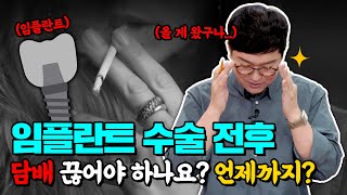 임플란트하면서 담배 펴도 되나요  임플란트 수술 예정자 필수 시청 영상 [upl. by Matland]