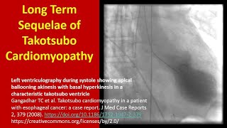 Long Term Sequelae of Takotsubo Cardiomyopathy [upl. by Elston634]