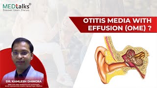 Otitis Media with Effusion OME [upl. by Bulley]