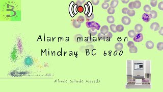 🛑Alarma malaria en Mindray BC6800🩸 IV 38 [upl. by Daahsar391]